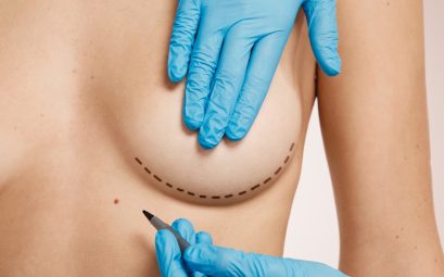 Augmentation mammaire à Paris : transformez votre silhouette !