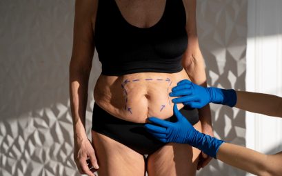 Abdominoplastie à Paris : comment choisir la clinique esthétique idéale ?