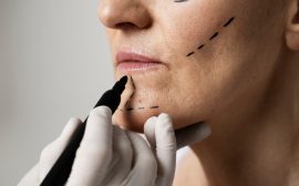 Chirurgie esthétique : préparation, déroulement et récupération