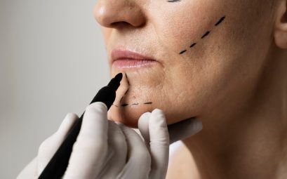 Chirurgie esthétique : préparation, déroulement et récupération